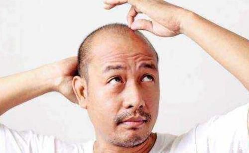 共性|雄性激素旺盛的男人,身上会有一些共性,就算只有1个也很不错