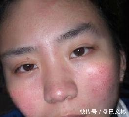 角质层|为何建议女生别“天天敷面膜”，这3个原因你得知道，不敢敷了