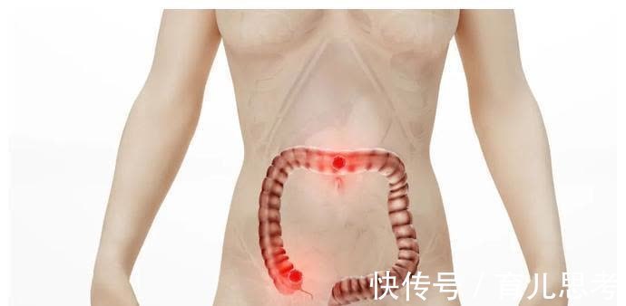 胰腺癌|癌症在发作前2年征兆,放到圈子很多人会感激你一辈子!