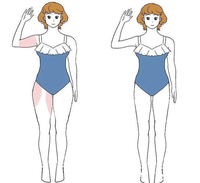 脂肪细胞 吸脂真的能做到想瘦哪里瘦哪里吗?吸脂术后都有哪些注意的呢?