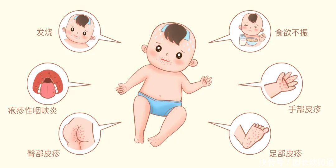 细菌性痢疾|幼儿园温馨提醒:夏季幼儿传染病防治指南来了,请家长查收!