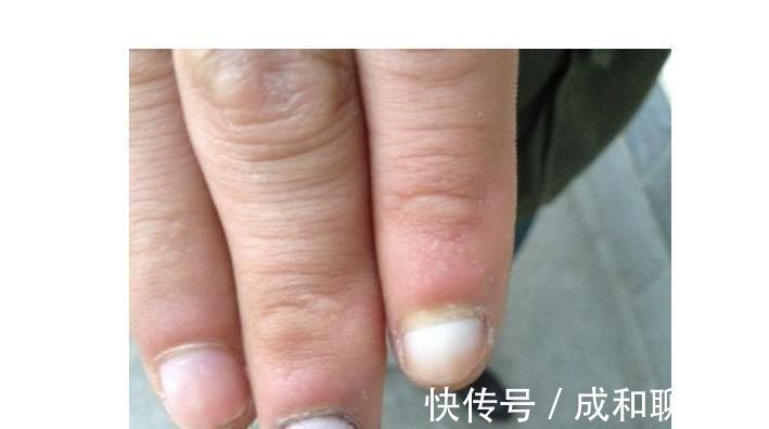 地方|身上这5个地方出现凸起,可能是身体的求救信号,还请及时就诊