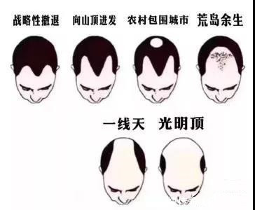 “秃”如其来，年纪轻轻的我，秃了？