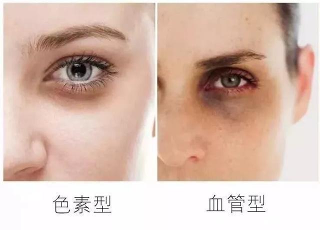 护肤|百无一用是眼霜