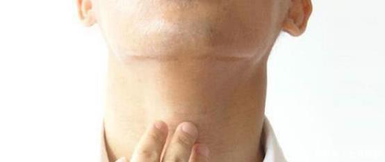  上看|以为是慢性咽炎，但查出食道癌！在症状上看，到底有何区别？