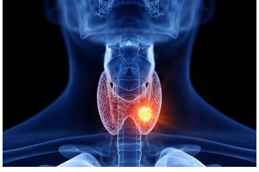 结节|退休中医：不小心患上甲状腺结节，建议收藏好这几种中成药，日后大有用处。