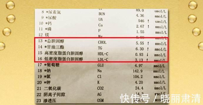 血脂偏高|医生:别搞错了,这项血脂偏高不需要治疗,而且还要想办法提高它