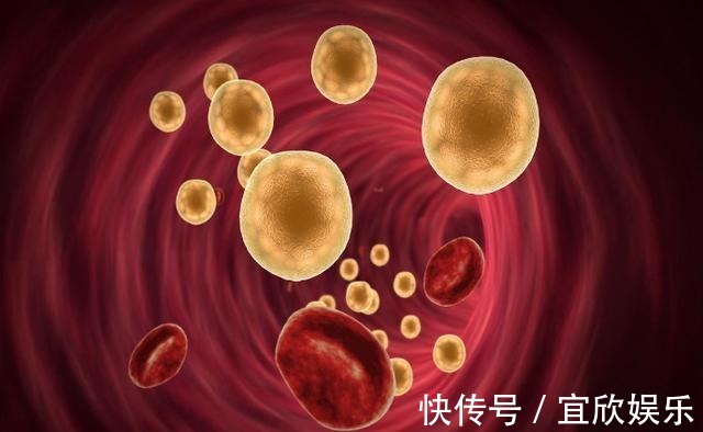 高脂血症|血脂高的人,眼睛可能有3个症状,若没有,说明血脂控制的还不错