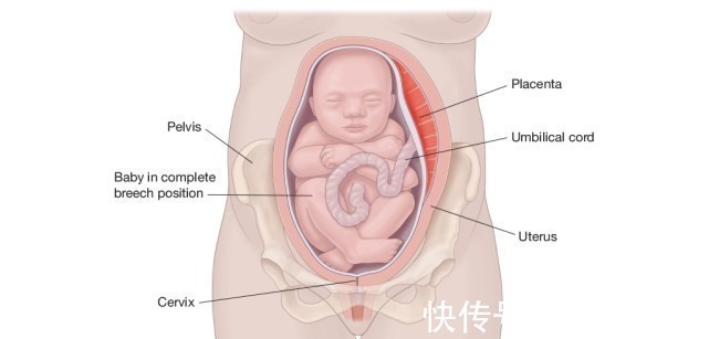 脐带|“哪种睡姿对胎儿发育好”真有讲究,孕妈别不把睡觉当回事,收藏