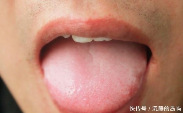 舌头|身体出了问题,舌下“青筋”会告诉你,这几个信号多注意