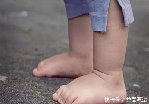 发育|宝宝大脑几岁会发育完全?三岁前出现这些标志,恭喜你,娃很聪明