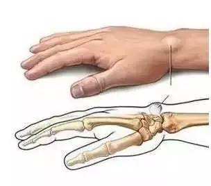 股四头肌|拉开身上“筋结”,体内百病去,8至80岁都适用,简单有效