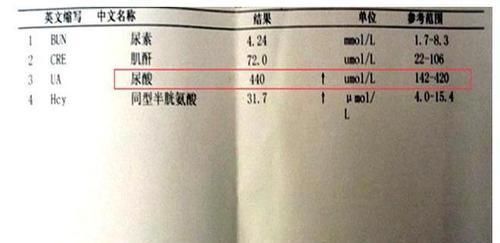 多喝|尿酸高对身体危害特别大,多喝这种水,尿酸痛风远离你