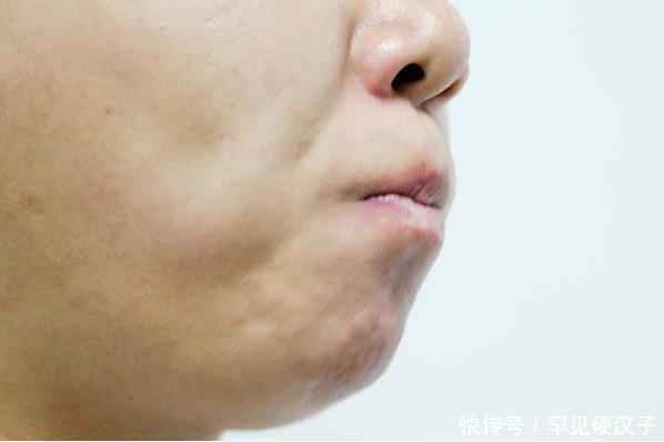 醒来|睡到半夜突然醒来,嘴巴又干又苦,6种疾病或许是“罪魁祸首”