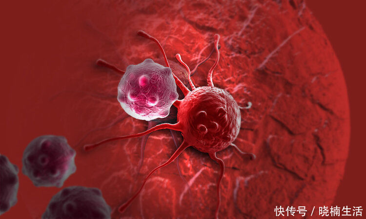 廣州復大腫瘤醫院|80歲癌癥擴散，現活到100歲無復發！醫生找到抗癌成功的關鍵