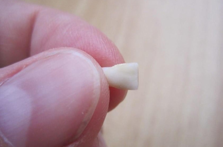 钱包君|宝宝乳牙掉了不要扔,重要时刻能救命现在流行的存乳牙真靠谱吗