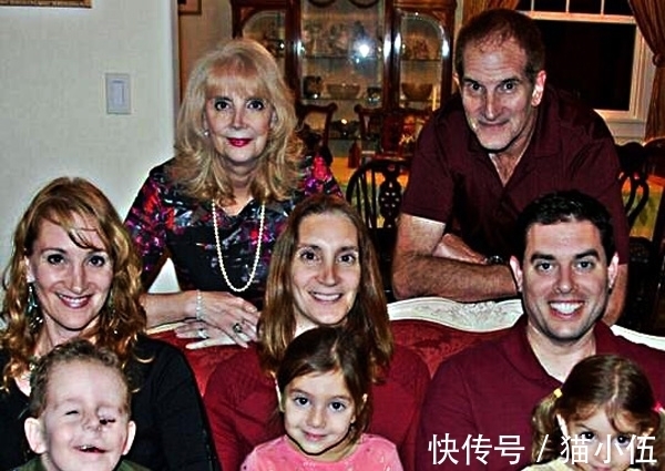 眼睛|小男孩出生时父母吓一跳,眼睛竟然长在脸上,长大后了不起!