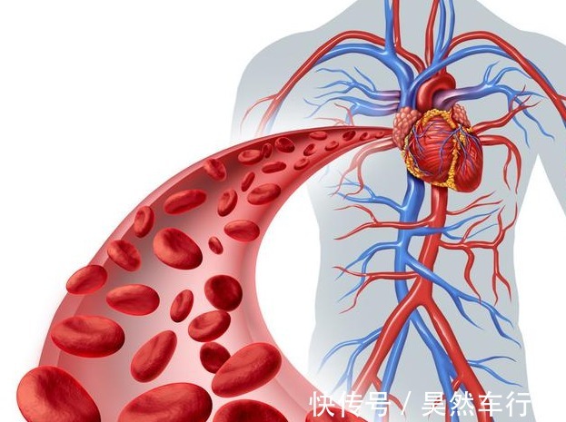 血管|高血压20年无并发症,只要做好这几点,你也可以