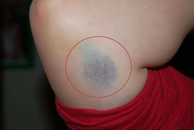 配方|一个化掉全身瘀血的经典配方，一凉一热，让你从头到脚不淤堵