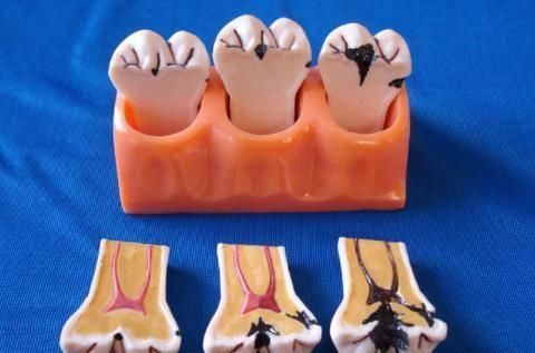 父母|2岁孩子满嘴“小黑牙”,医生不是因为糖,是父母的无知