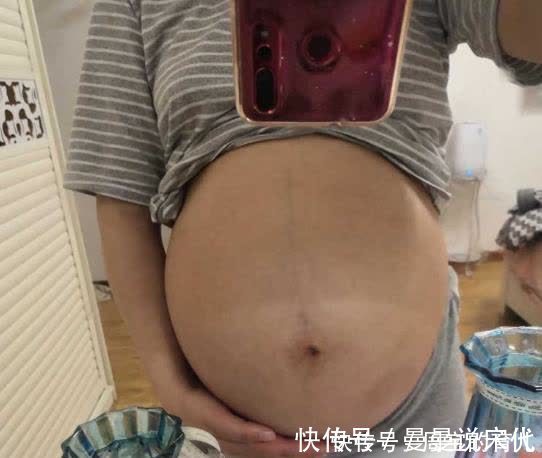 妊娠|晚孕肚子痒，可能暗示这一征兆，准妈妈别疏忽