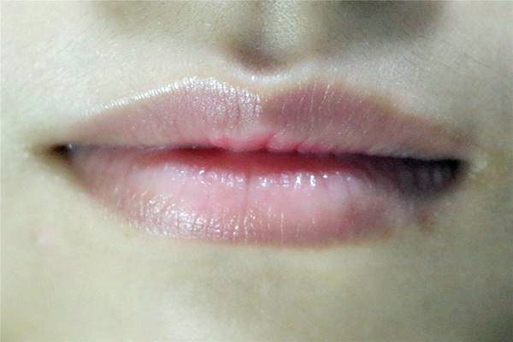 女性|女人有妇科病，嘴巴常会有几种表现暗示你，希望你一个都没有