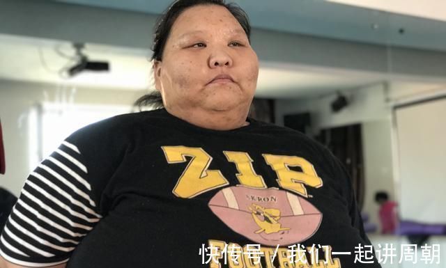 减肥|400斤女孩把床压塌只敢睡地上，今减掉230斤美的连亲妈都认不出