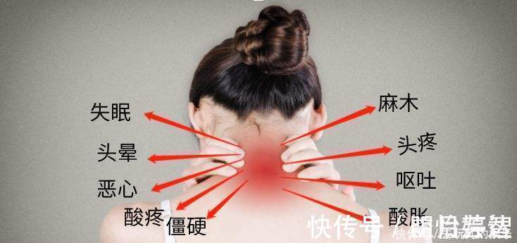 威灵仙|国医大师治颈椎病的一个经验方,只需3味中药,就能拔掉病根