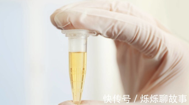 血糖|血糖高不高,小便就知道!排尿出现3种“异常”,可能是糖尿病
