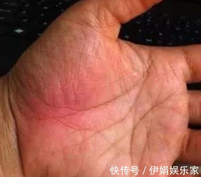 肺经|手上的这块肉,是健康的“报警器”,一看就知身体好坏,很灵的