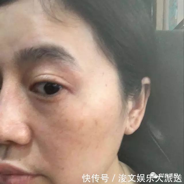 玉米|玉米配生姜不是奇迹,46岁大妈淡化20年的斑,瞬间年轻20岁