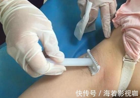 分娩|男医生要给产妇“刮毛”,丈夫自告奋勇,医生你想的太简单了