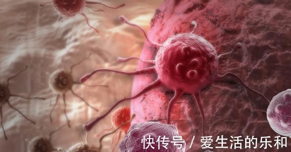 癌症|早上起床时,没有4个表现,那就恭喜你,没有被癌细胞“看中”!