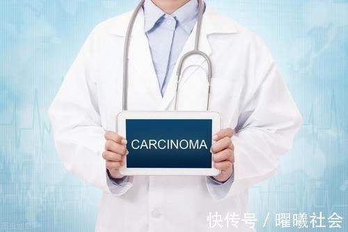 治愈|癌症早期能活多长时间?肿瘤科医生实话实说