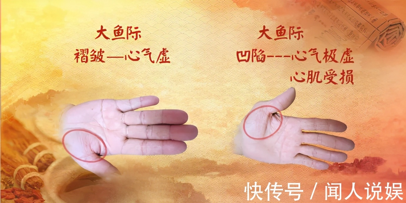 青筋|身体好不好，看手就知道！这几处变化可能藏大病