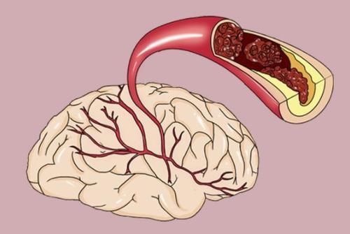 糖尿病患者|有糖尿病的人要远离豆腐？提醒：不想血糖升高，这3种素食要少吃