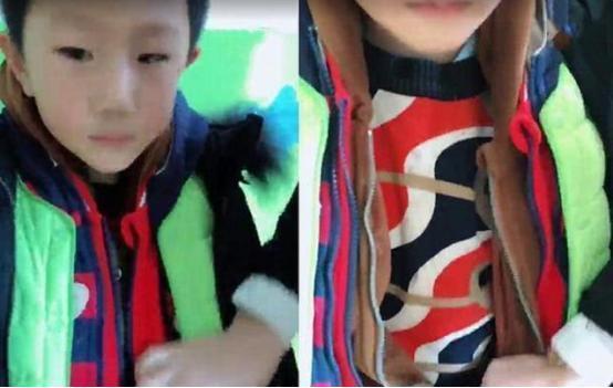 皮肤疾病|有一种冷叫“妈妈觉得你冷”,男孩穿8件衣服上学,老师哭笑不得