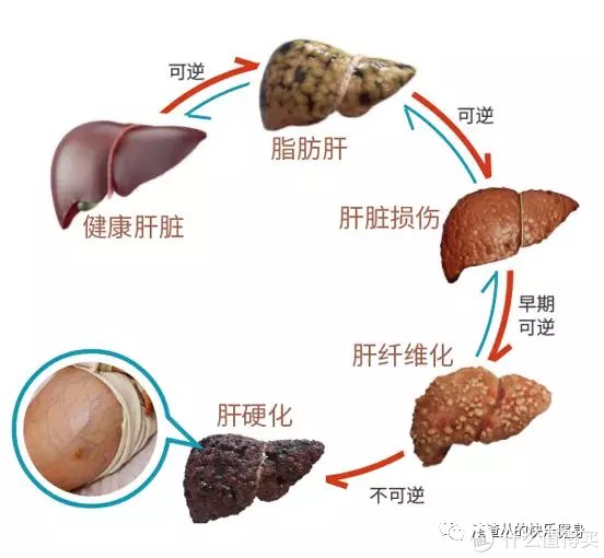 干货|两步改善「脂肪肝」,简单易懂好上手的实操干货来啦~