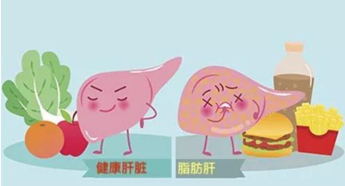 饮食|身体若有脂肪肝，一定会有这些表现，得了脂肪肝如何饮食？