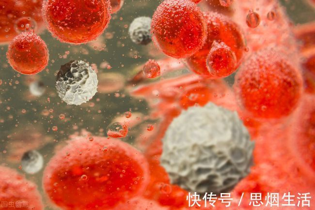 胆固醇|大鱼大肉并不是高血脂的源头，医生告诫：这3物才是劝你管住嘴