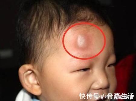 静静|1岁宝宝半夜摔下床,妈妈做法让婆婆直呼冷血,医生直言:做得对