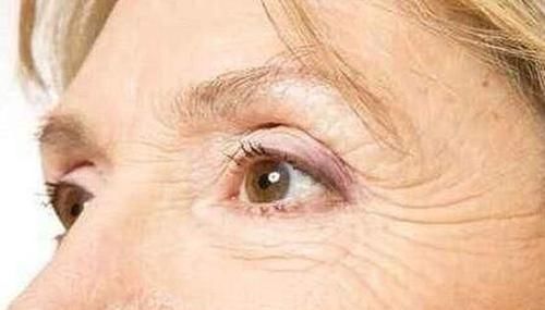 早衰|女性头部出现5个变化，或许是“早衰”的标志，要留心