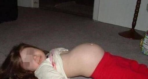 肥胖症|五岁女儿肚子巨大,以为得了肥胖症,检查结果家人难以接受