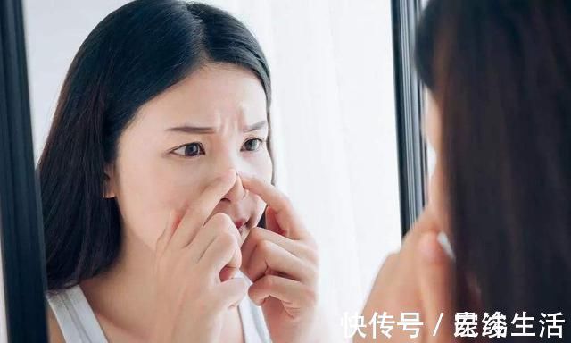 含糖量|鼻翼上的黑头该怎么去掉牢记这几招,让我们轻松告别“草莓鼻”