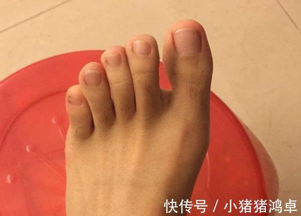 堵塞|脚上发出四个“信号”，可能是血管阻塞的前兆，建议你不要忽视！