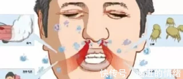鼻涕|鼻炎发作很难受一把小葱, 不出半月, 鼻涕消了, 鼻炎也见好!