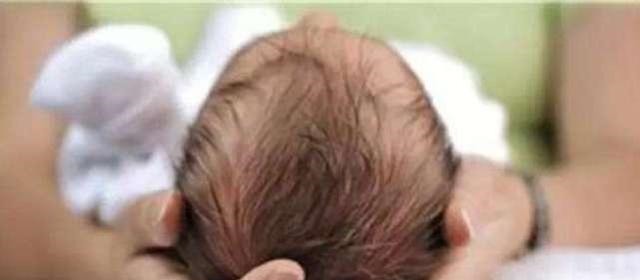 幸孕姐|宝宝头型如何纠正医生六种好方法,超过这个月份,真的没救了!