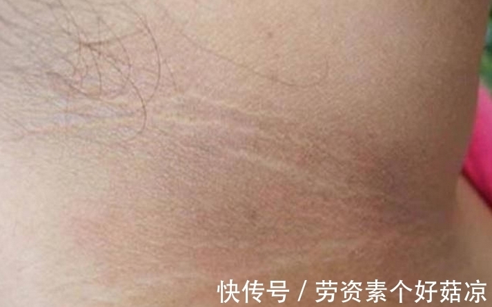 妈妈|6岁小女孩脖颈发黑洗不掉,去医院做检查,医生的话让妈妈笑了