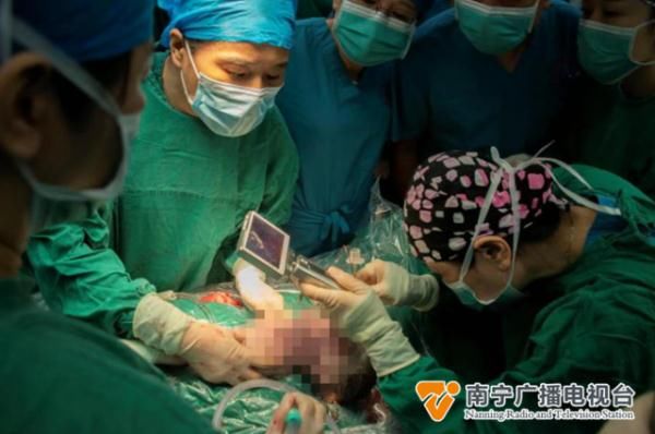 广西壮族自治区妇幼保健院|广西完成首例“产时胎儿手术” ，巨大肿瘤被成功摘除