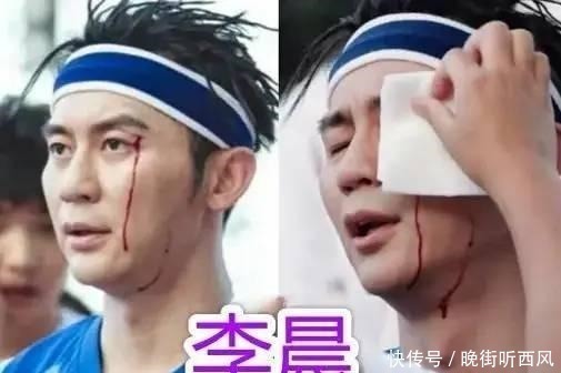 录综艺危险多邓超打石膏、鹿晗伤病,而他血流不止!